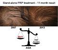 Click image for larger version

Name:	ACell-PRP-Closeup.jpg
Views:	410
Size:	88.7 KB
ID:	438363