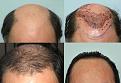Click image for larger version

Name:	quad.jpg
Views:	305
Size:	93.8 KB
ID:	438388