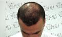 Click image for larger version

Name:	scott-baldness-emphasised-1.jpg
Views:	445
Size:	61.6 KB
ID:	438430