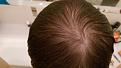 Click image for larger version

Name:	crown wet out of shower.jpg
Views:	900
Size:	92.8 KB
ID:	438444