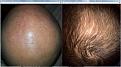 Click image for larger version

Name:	Crown top 12 Month.jpg
Views:	3850
Size:	98.6 KB
ID:	438467