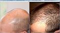 Click image for larger version

Name:	Left Far.jpg
Views:	7518
Size:	99.3 KB
ID:	438468