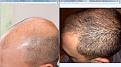 Click image for larger version

Name:	Left Far2.jpg
Views:	2741
Size:	98.3 KB
ID:	438469