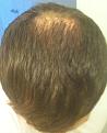 Click image for larger version

Name:	bald8.jpg
Views:	476
Size:	96.8 KB
ID:	438518