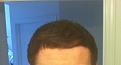 Click image for larger version

Name:	bald9 (2).jpg
Views:	521
Size:	76.9 KB
ID:	438519