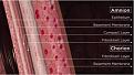 Click image for larger version

Name:	amniotic_membrane.jpg
Views:	351
Size:	20.4 KB
ID:	438774