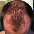 Click image for larger version

Name:	pre-op half3.jpg
Views:	416
Size:	86.6 KB
ID:	438798