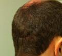 Click image for larger version

Name:	day1-3.jpg
Views:	401
Size:	34.1 KB
ID:	438801