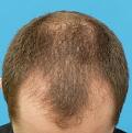 Click image for larger version

Name:	pre-op3 (clinic).jpg
Views:	392
Size:	84.0 KB
ID:	438829