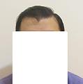 Click image for larger version

Name:	Wet hair front.jpg
Views:	895
Size:	24.0 KB
ID:	439131