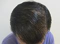 Click image for larger version

Name:	Wet hair top.jpg
Views:	1022
Size:	83.1 KB
ID:	439133