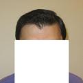Click image for larger version

Name:	Dry hair front.jpg
Views:	929
Size:	29.8 KB
ID:	439134