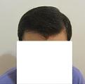 Click image for larger version

Name:	Dry hair mid.jpg
Views:	867
Size:	36.4 KB
ID:	439135
