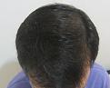 Click image for larger version

Name:	Dry hair top.jpg
Views:	897
Size:	72.3 KB
ID:	439136