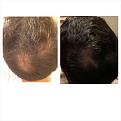 Click image for larger version

Name:	PhotoGrid_1415871128509.jpg
Views:	543
Size:	83.9 KB
ID:	439148