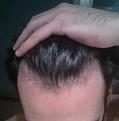 Click image for larger version

Name:	IMG_20141205_192201.jpg
Views:	392
Size:	39.7 KB
ID:	439230