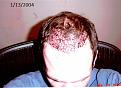 Click image for larger version

Name:	2004_hair_1day_after.jpg
Views:	914
Size:	90.5 KB
ID:	439257