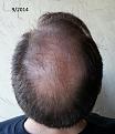 Click image for larger version

Name:	Sept_2014_Crown.jpg
Views:	2031
Size:	91.6 KB
ID:	439258