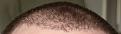 Click image for larger version

Name:	hairline.jpg
Views:	878
Size:	104.2 KB
ID:	439368