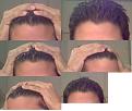Click image for larger version

Name:	more hair.jpg
Views:	469
Size:	12.4 KB
ID:	439369