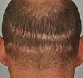 Click image for larger version

Name:	pre with 2 guard cut.jpg
Views:	659
Size:	96.7 KB
ID:	439458