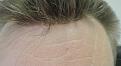 Click image for larger version

Name:	0preophairpiece (1).jpg
Views:	442
Size:	91.4 KB
ID:	439586