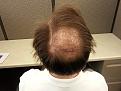 Click image for larger version

Name:	Crown 1.5 months.jpg
Views:	493
Size:	94.0 KB
ID:	440159