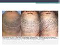Click image for larger version

Name:	Slide5.JPG
Views:	813
Size:	81.5 KB
ID:	440194