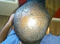 Click image for larger version

Name:	Pre op 4.jpg
Views:	381
Size:	91.9 KB
ID:	440204