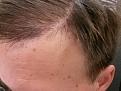 Click image for larger version

Name:	4 months Frontclose.jpg
Views:	468
Size:	84.6 KB
ID:	440388
