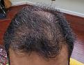 Click image for larger version

Name:	Hair-1.12016-1.jpg
Views:	452
Size:	91.4 KB
ID:	440444