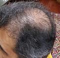 Click image for larger version

Name:	Hair-1.12016-2.jpg
Views:	441
Size:	96.4 KB
ID:	440445