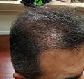 Click image for larger version

Name:	Hair-1.12016-3.jpg
Views:	442
Size:	94.0 KB
ID:	440446