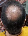 Click image for larger version

Name:	Hair-1.12016-4.jpg
Views:	419
Size:	98.7 KB
ID:	440447