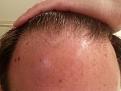 Click image for larger version

Name:	Front Before Surgery1.jpg
Views:	432
Size:	88.9 KB
ID:	440451