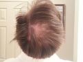 Click image for larger version

Name:	Crown Before Surgery.jpg
Views:	439
Size:	80.8 KB
ID:	440452