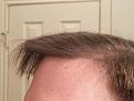 Click image for larger version

Name:	Front 6 months side.jpg
Views:	417
Size:	83.3 KB
ID:	440456