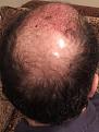 Click image for larger version

Name:	FullSizeRender (2).jpg
Views:	967
Size:	86.8 KB
ID:	440472