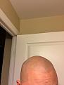 Click image for larger version

Name:	after 1st - after shave - right.jpg
Views:	1103
Size:	60.4 KB
ID:	440635
