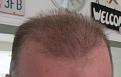 Click image for larger version

Name:	IMG_4479_cropped__1461512912_23802.jpg
Views:	587
Size:	49.7 KB
ID:	440705
