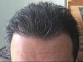Click image for larger version

Name:	Hair-April 13, 2016-1.jpg
Views:	669
Size:	30.1 KB
ID:	440776