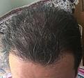 Click image for larger version

Name:	Hair-April 13, 2016-2.jpg
Views:	610
Size:	87.2 KB
ID:	440777