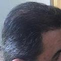 Click image for larger version

Name:	Hair-April 13, 2016-3.jpg
Views:	613
Size:	33.3 KB
ID:	440778