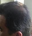 Click image for larger version

Name:	Hair-April 13, 2016-4.jpg
Views:	604
Size:	37.8 KB
ID:	440779