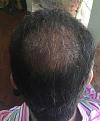 Click image for larger version

Name:	Hair-April 13, 2016-5.jpg
Views:	595
Size:	39.2 KB
ID:	440780