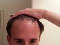 Click image for larger version

Name:	HairlineBefore.jpg
Views:	173
Size:	88.8 KB
ID:	440892