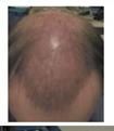Click image for larger version

Name:	Hair front third.jpg
Views:	292
Size:	4.0 KB
ID:	440959