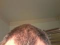 Click image for larger version

Name:	2016HAIRLINE.jpg
Views:	1603
Size:	86.5 KB
ID:	440988
