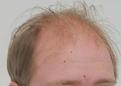 Click image for larger version

Name:	before.jpg
Views:	401
Size:	93.3 KB
ID:	441734
