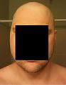 Click image for larger version

Name:	BaldFront.jpg
Views:	866
Size:	79.5 KB
ID:	441794